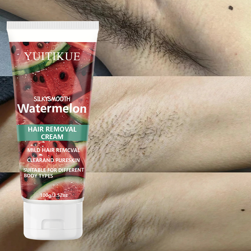 YUITIKUE Watermelon Hair Remov - Hair Removal Cream 리뷰 및 가격